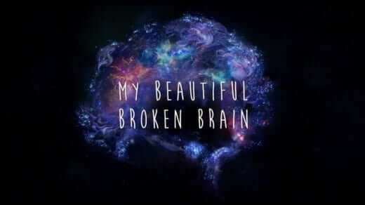 My Beautiful Broken Brain 1
