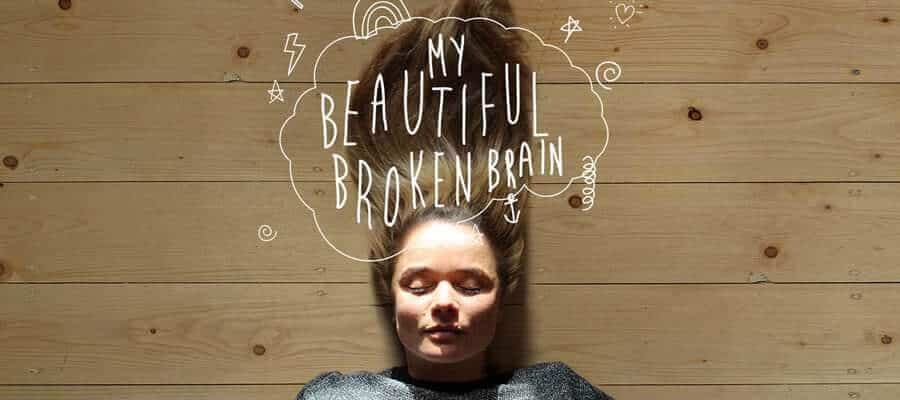 My Beautiful Broken Brain