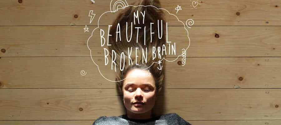 my-beautiful-broken-brain