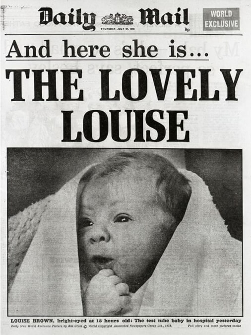 newspaper for the lovely louise ivf baby