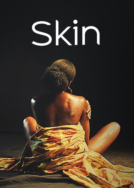 Skin on Netflix